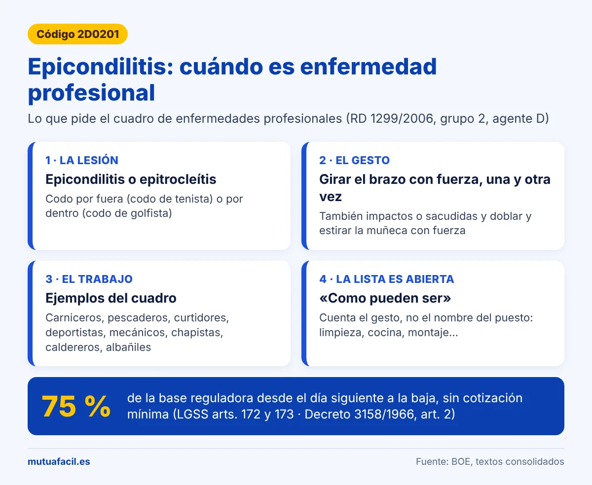 Infografía: epicondilitis como enfermedad profesional, código 2D0201 del RD 1299/2006; la lesión, el gesto de girar el brazo con fuerza, los oficios del cuadro (carniceros, mecánicos, albañiles…), lista abierta y baja al 75 % desde el día siguiente
